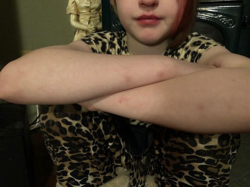 caption: <p>Lilli, a fifth grader in Salem-Keizer Public Schools, folds her arms to show small bruises the family said came from school staff members restraining her.&nbsp;</p>