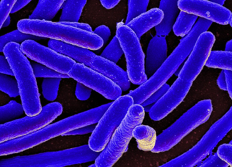 caption: E. coli.