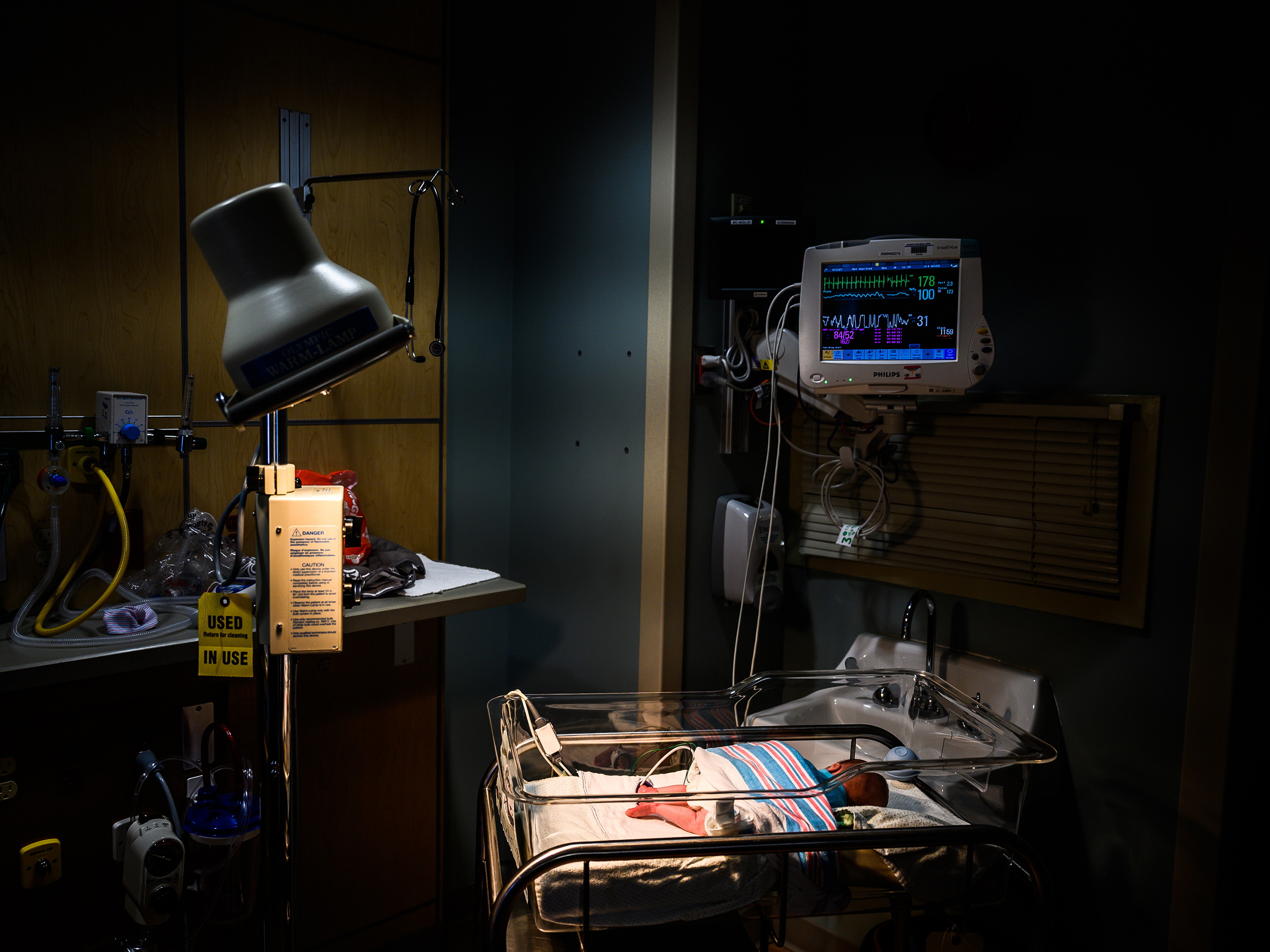 caption: Infants exposed to opioids in utero often experience symptoms of withdrawal. An infant is being monitored for opioid withdrawal inside a neonatal intensive care unit at the CAMC Women and Children's Hospital in June 2019, in Charleston, W.Va.