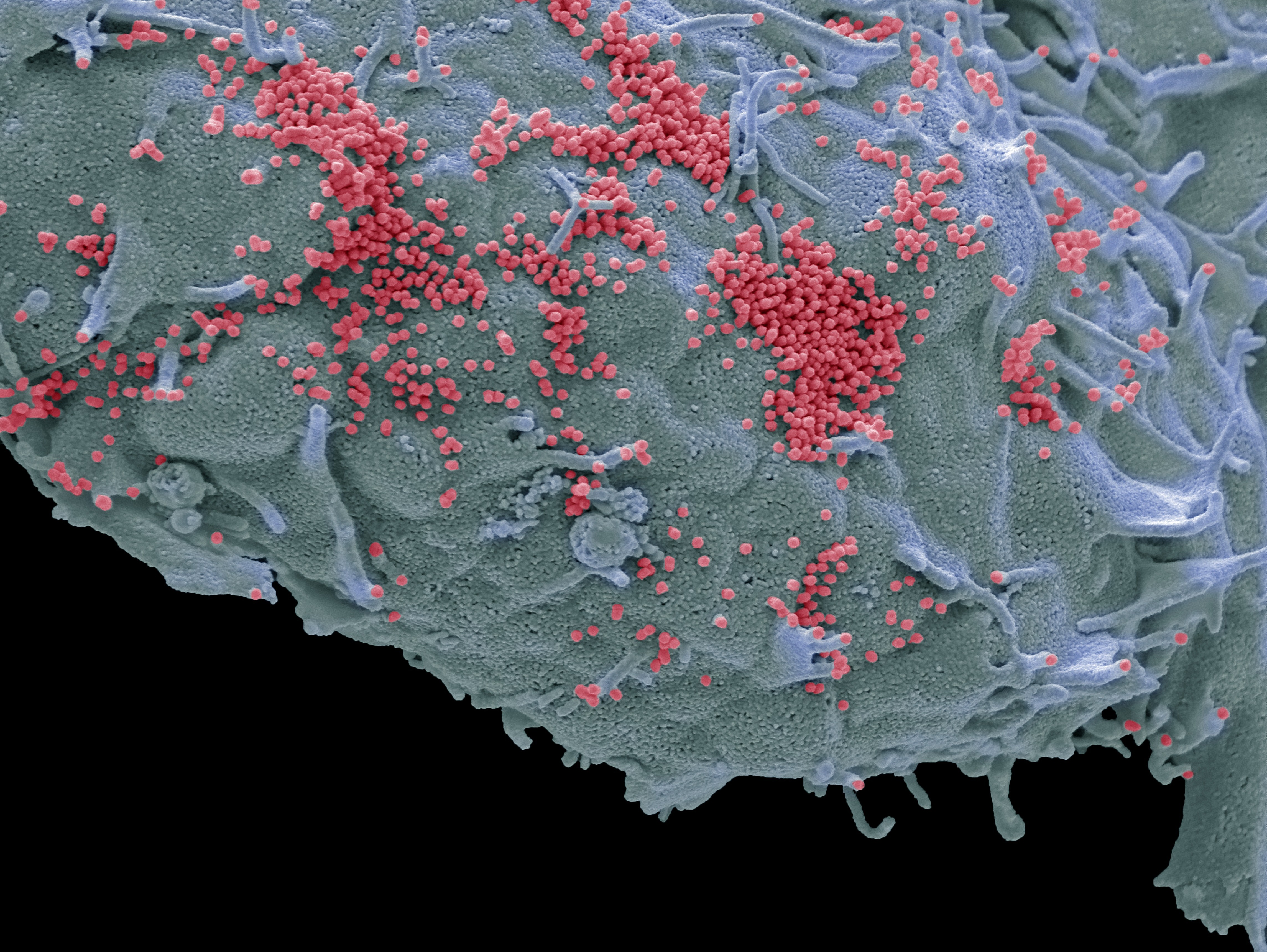 caption: This colorized scanning electron micrograph shows human cells in a lab infected with "pink" influenza viruses. As many as 650,000 people each year die from flu, according to the World Health Organization.