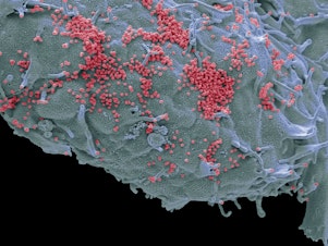 caption: This colorized scanning electron micrograph shows human cells in a lab infected with "pink" influenza viruses. As many as 650,000 people each year die from flu, according to the World Health Organization.
