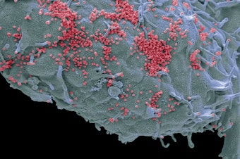 caption: This colorized scanning electron micrograph shows human cells in a lab infected with "pink" influenza viruses. As many as 650,000 people each year die from flu, according to the World Health Organization.