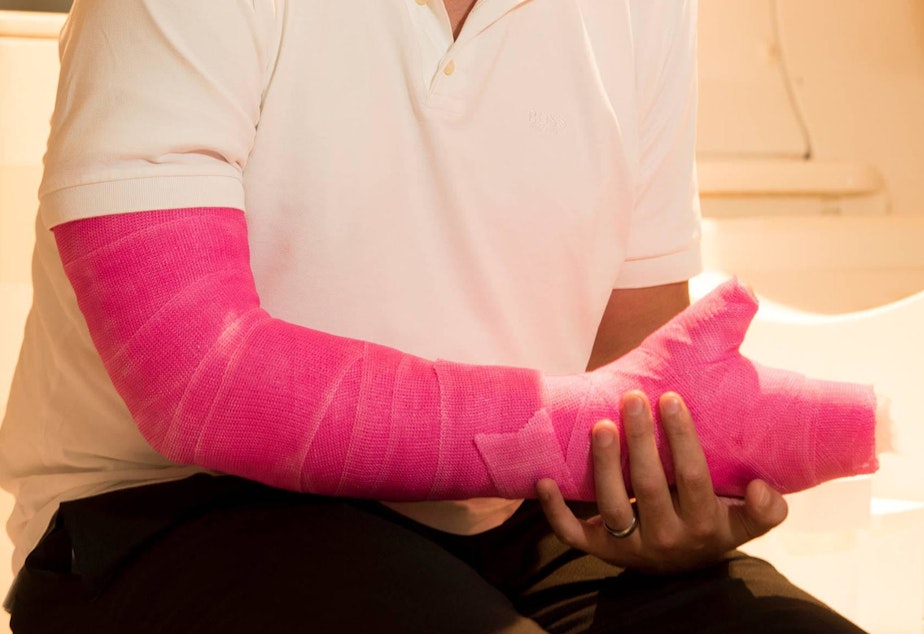 Kuow A Scientist S Pink Cast Leads To Discovery About How The Brain Responds To Disability Kuow A Scientist S Pink Cast Leads To Discovery About How The Brain Responds To Disability