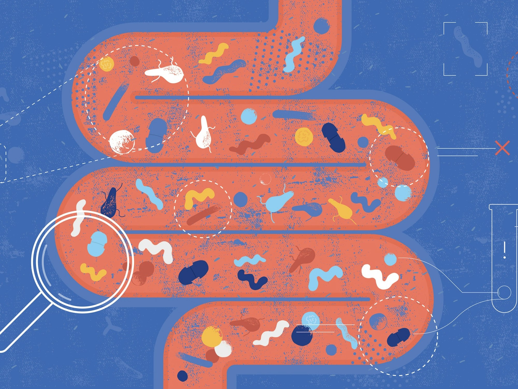Scientists search the microbiome for clues to the rise in colorectal cancers