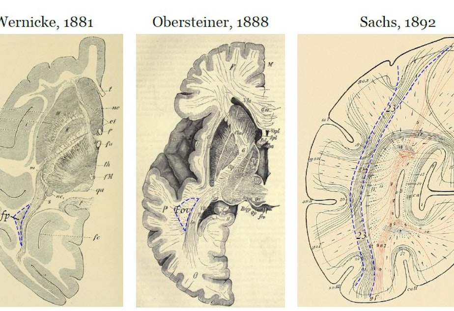 caption: The first schematics of this lost part of the brain in monkey and human. Researchers today have found that this area, called the vertical occipital fasciculus, stems from the brain's visual processing system.