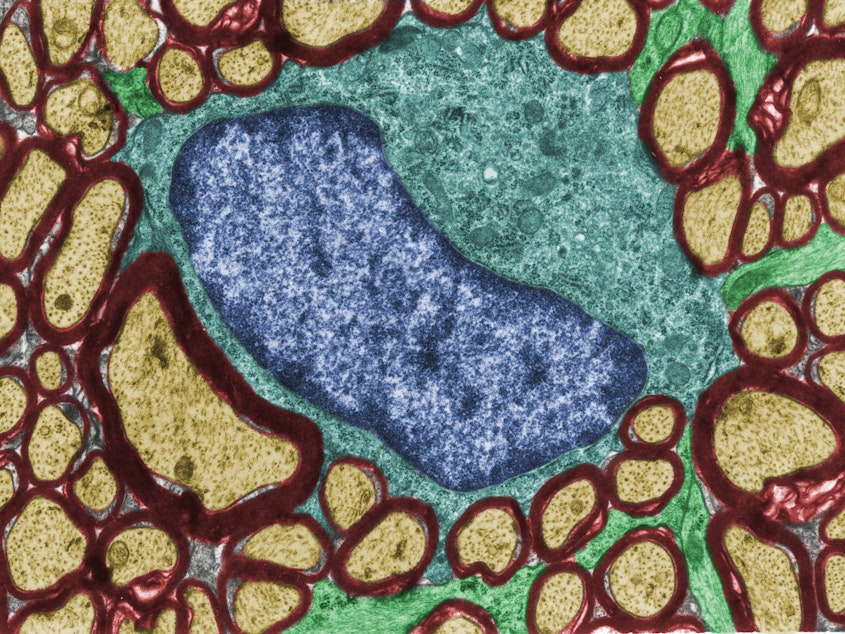 caption: This image from an electron microscope shows a cross-sectional view of an oligodendrocyte (blue) among nerve fibers coated with myelin (dark red). In models of autism spectrum disorder, oligodendrocytes appear to create too much or too little myelin.