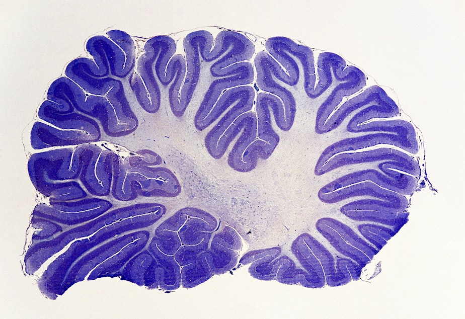 The cerebellum, a brain structure humans share with fish and lizards, appears to control the quality of many functions in the brain.