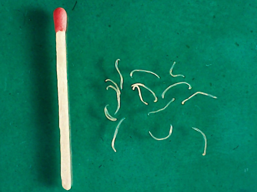 caption: Adult hookworms, from a dog. The larva, which penetrate the skin, are even smaller.