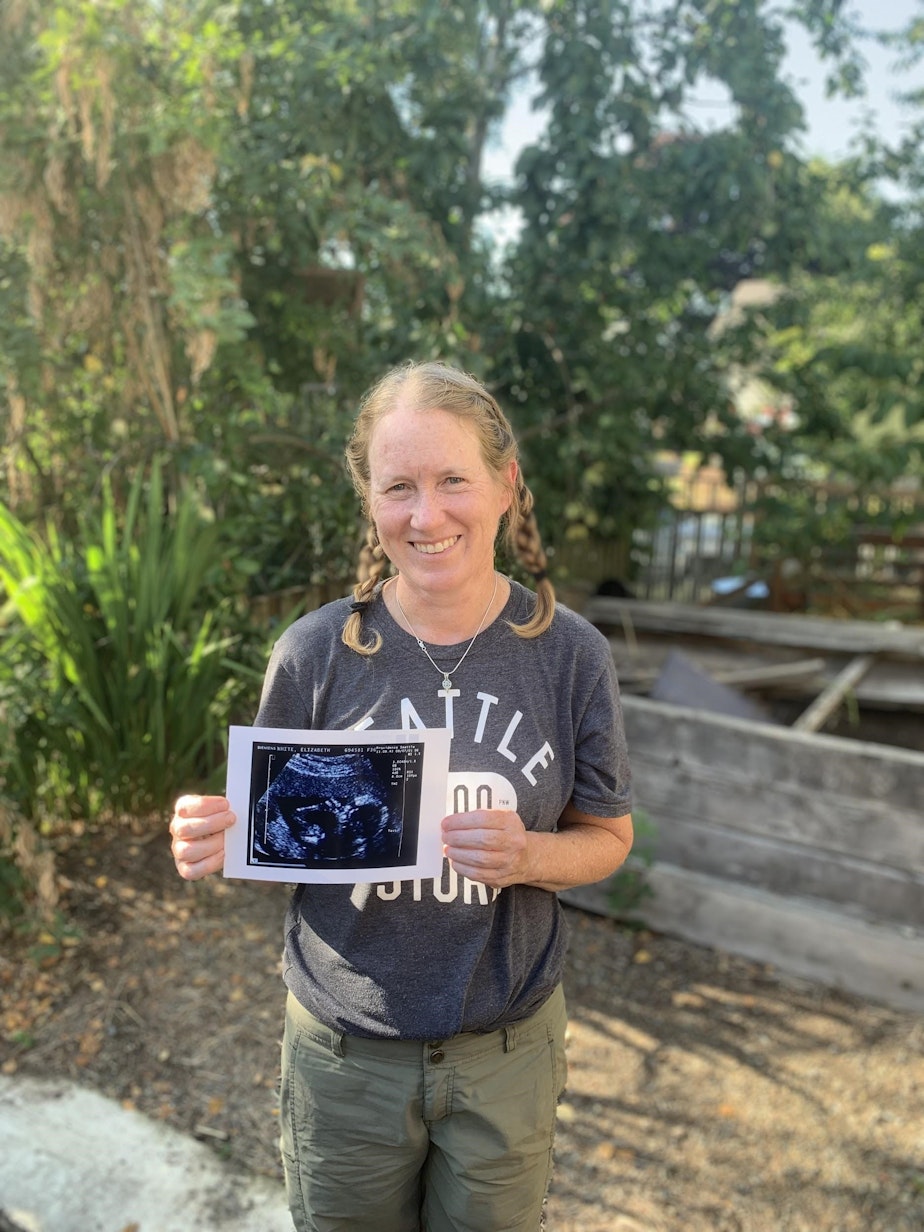 caption: Liza White, Morgen's mother, holds the ultrasound from her pregnancy with Morgen.