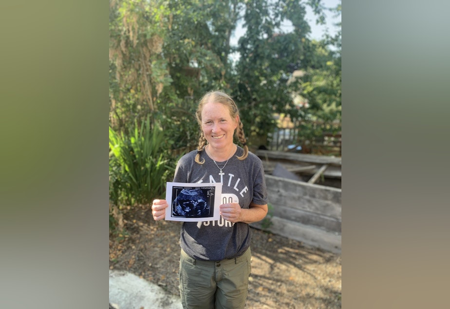 caption: Liza White, Morgen's mother, holds the ultrasound from her pregnancy with Morgen.