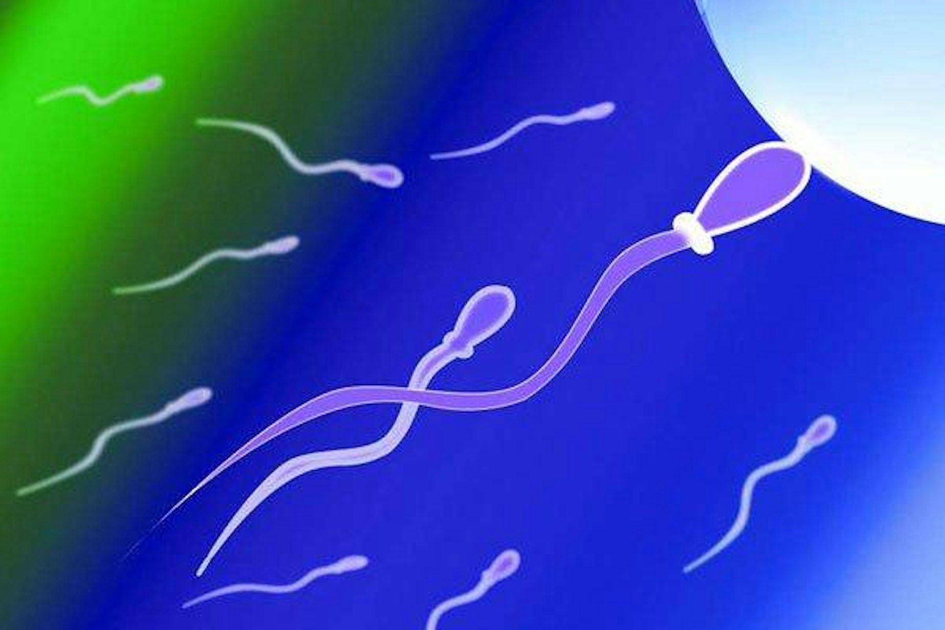 Сперматозоиды жёлтого оттенка