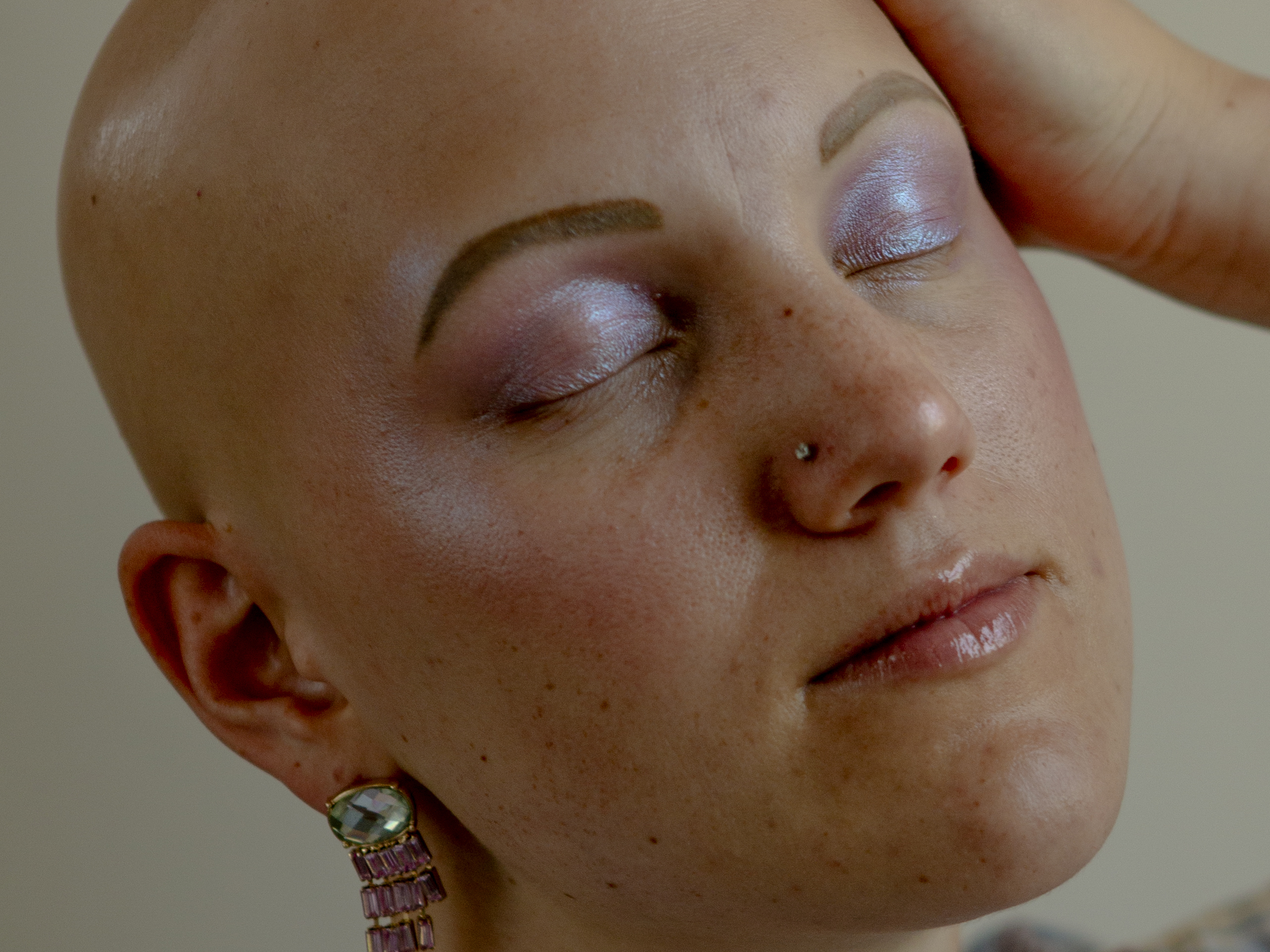 caption: "I don't want people treating me differently just because I have alopecia. I'm healthy. I can do everything you can do. I just don't have hair." Jenny Jobson