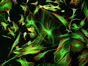 caption: Astrocyte cells like these from the brain of a mouse may differ subtly from those in a human brain.