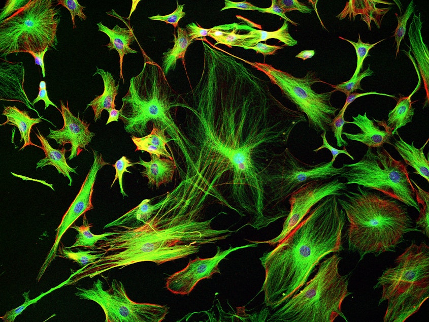 caption: Astrocyte cells like these from the brain of a mouse may differ subtly from those in a human brain.