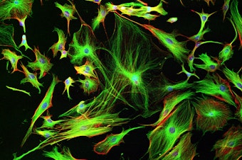 caption: Astrocyte cells like these from the brain of a mouse may differ subtly from those in a human brain.