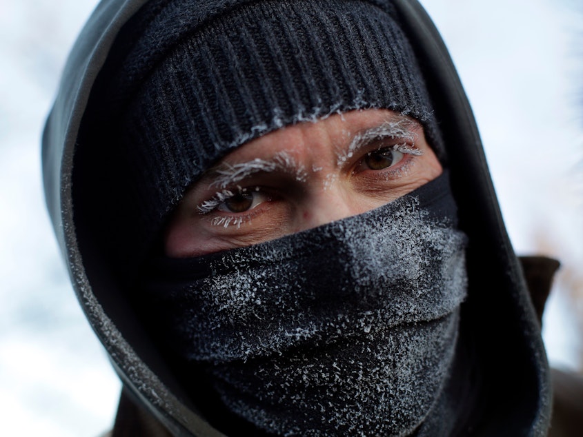 caption: Frank Lettiere's eyebrows and eyelashes froze after his walk along Lake Michigan's Chicago shoreline Wednesday. Frostbite warnings were issued for parts of the U.S. Midwest as temperatures plunged.