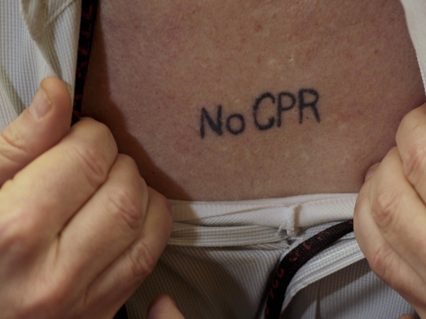 caption: Some people have their medical wished tattooed on their bodies. CPR can save lives, especially for the young and healthy, but can add pain and chaos to a frail, sick patient's last moments.