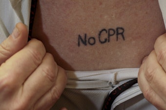 caption: Some people have their medical wished tattooed on their bodies. CPR can save lives, especially for the young and healthy, but can add pain and chaos to a frail, sick patient's last moments.