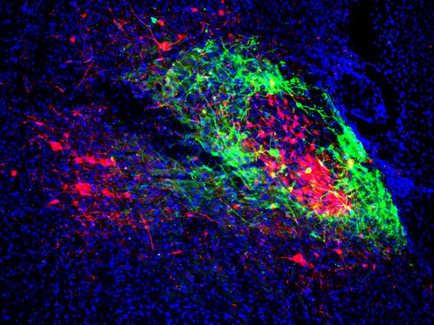 caption: Shell neurons (green) project to the breathing center and core neurons (red) project to the pain/emotion center. Brain scientists have found the two are linked, shedding new light on opioid overdoses