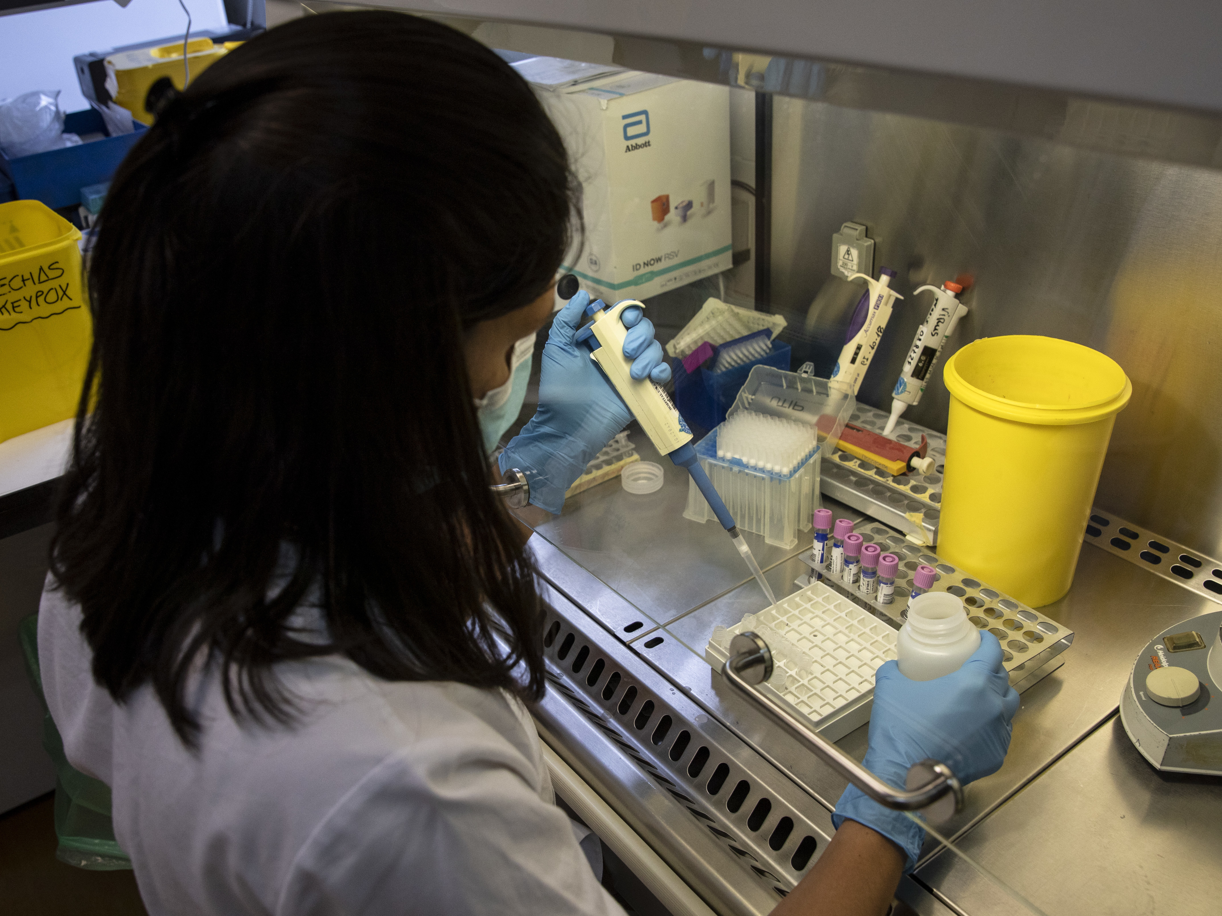 caption: Europe is at the center of the monkeypox outbreak — and it must act quickly to prevent the virus from becoming established, the WHO says. Here, a medical laboratory technician works with suspected monkeypox samples to be tested at La Paz hospital in Madrid, Spain, last month.