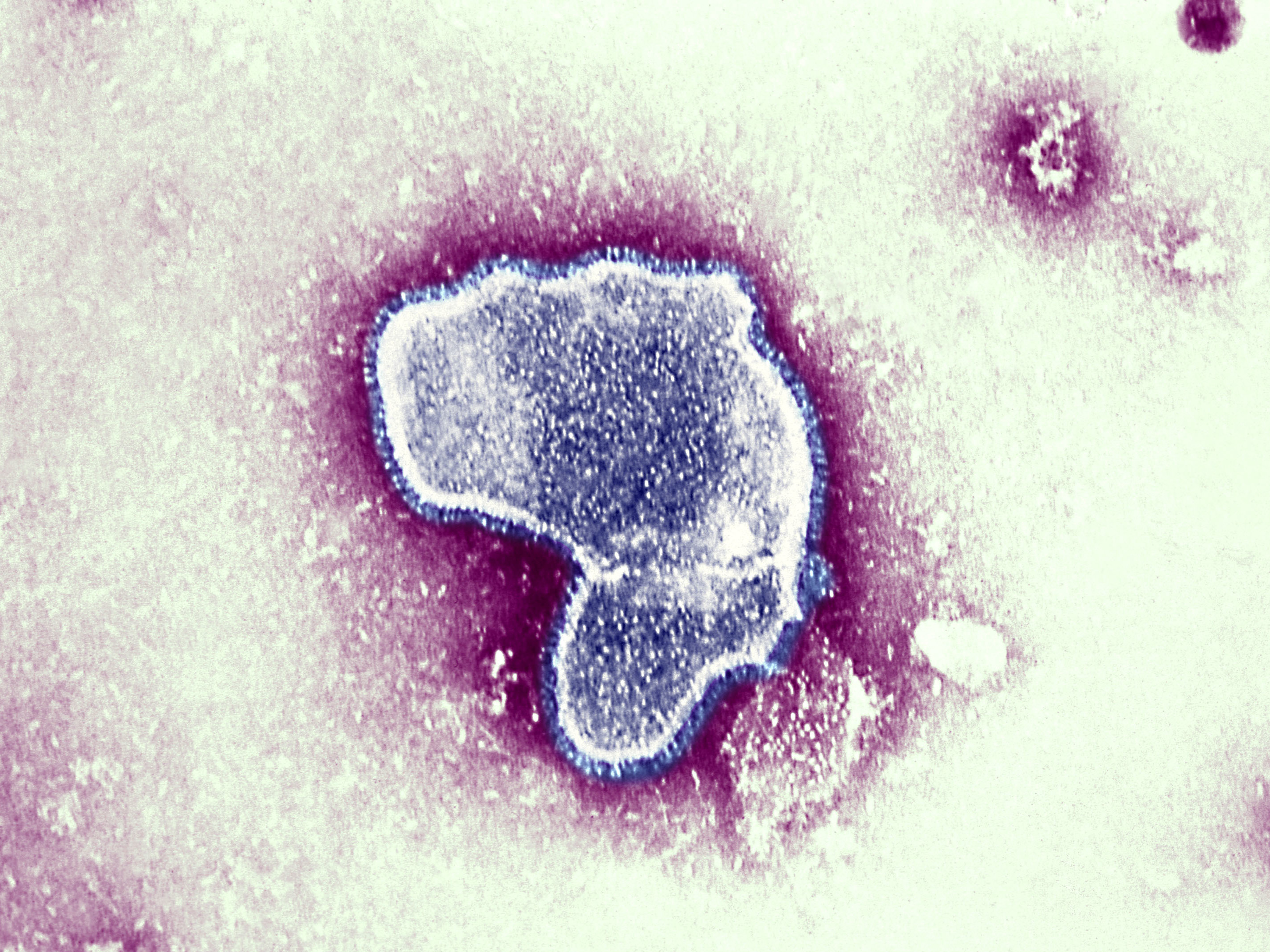caption: At the moment there is little data available on the impact of contracting COVID-19 and the respiratory syncytial virus (pictured), and whether together they can make a person sicker. But health officials worry it could put young patients — who are not eligible for the coronavirus vaccine — at greater risk.