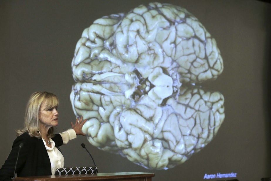 caption: In this Thursday, Nov. 9, 2017 file photo, Ann McKee, director Boston University's center for research into the degenerative brain disease chronic traumatic encephalopathy, or CTE, addresses an audience on the school's campus about the study of NFL football player Aaron Hernandez's brain, projected on a screen behind in Boston. 