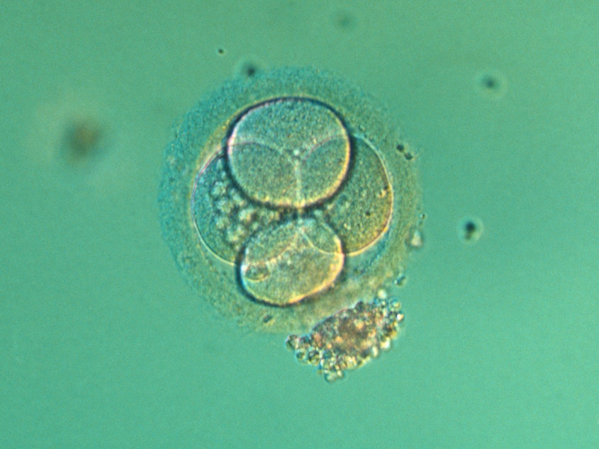 caption: New guidance would ease restrictions on researching embryos in the lab.