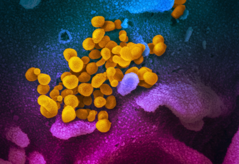caption: The coronavirus that causes COVID-19 is seen in yellow, emerging from cells (in blue and pink) cultured in the lab. This image is from a scanning electron microscope.