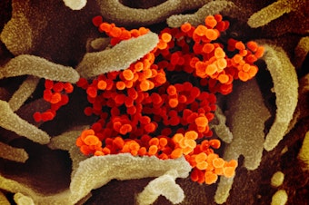caption: In this image from a scanning electron microscope, the new coronavirus is in orange.