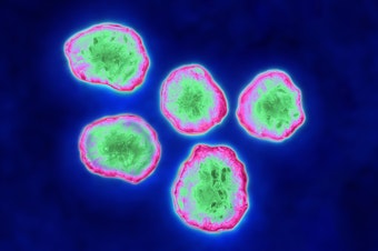 caption: New research illuminates how the measles virus may suppress the immune system after an infection.