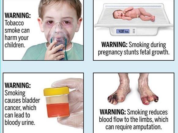 caption: The U.S. Food and Drug Administration plans to require tobacco companies to include 13 health warnings on cigarette packaging and advertisements.