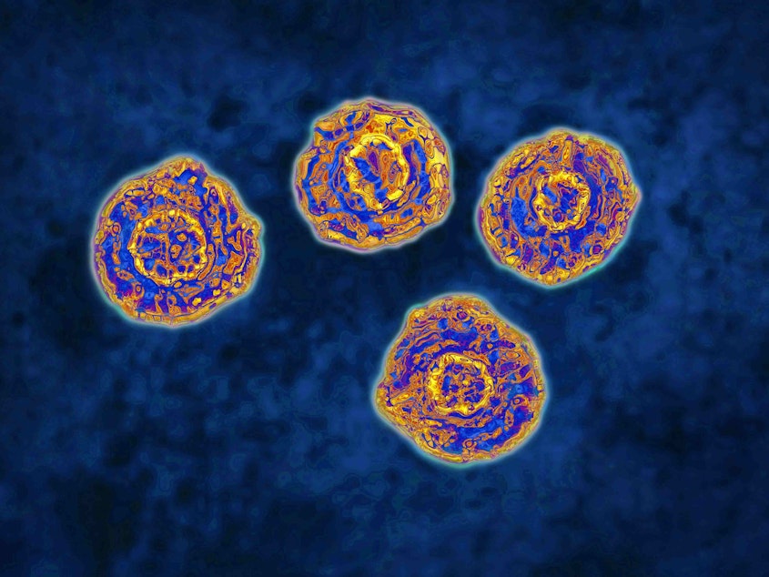 caption: Hepatitis C can cause severe liver damage and leads to about 15,000 deaths in the U.S. each year.