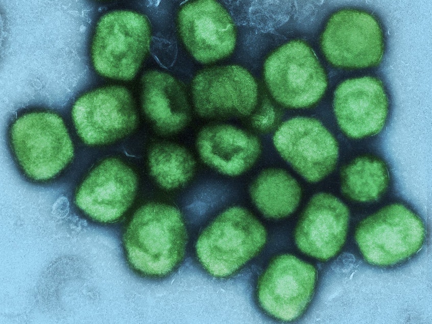 caption: This image shows purified particles of mpox virus, formerly called monkeypox. Viruses like these can be genetically altered in the lab in ways that might make them more dangerous.