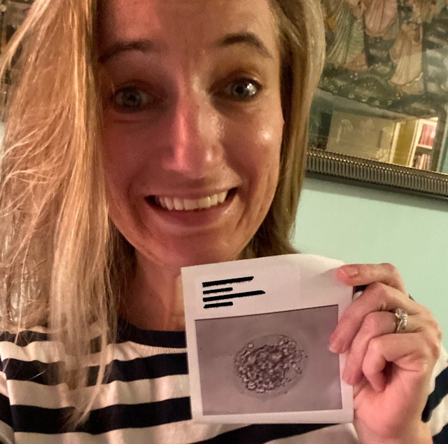 caption: Anna Scott holds a photo showing that she is pregnant.