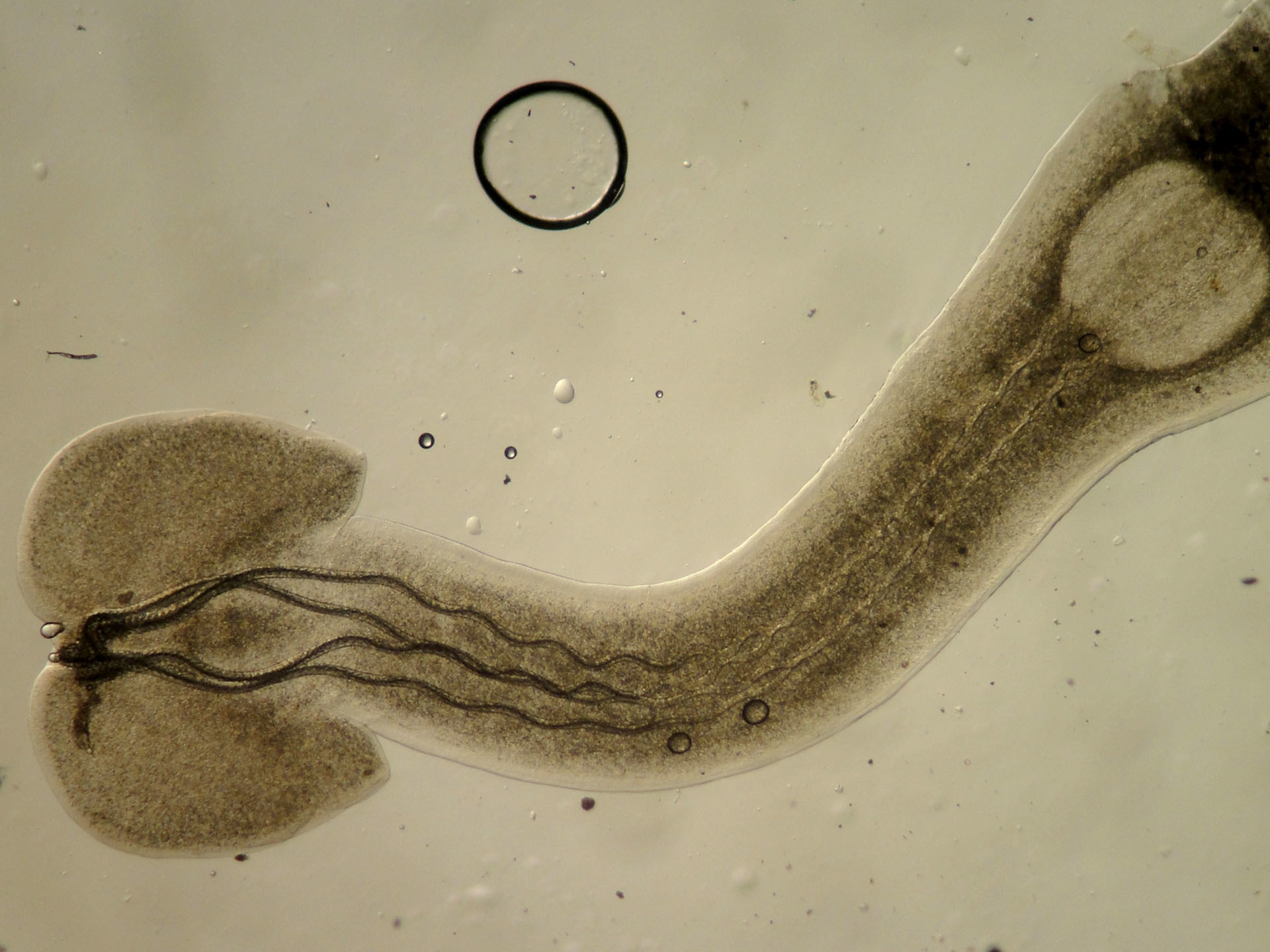 caption: Parasites play crucial roles in keeping ecosystems healthy, as does this larval trypanorhynch tapeworm, which infects fish.