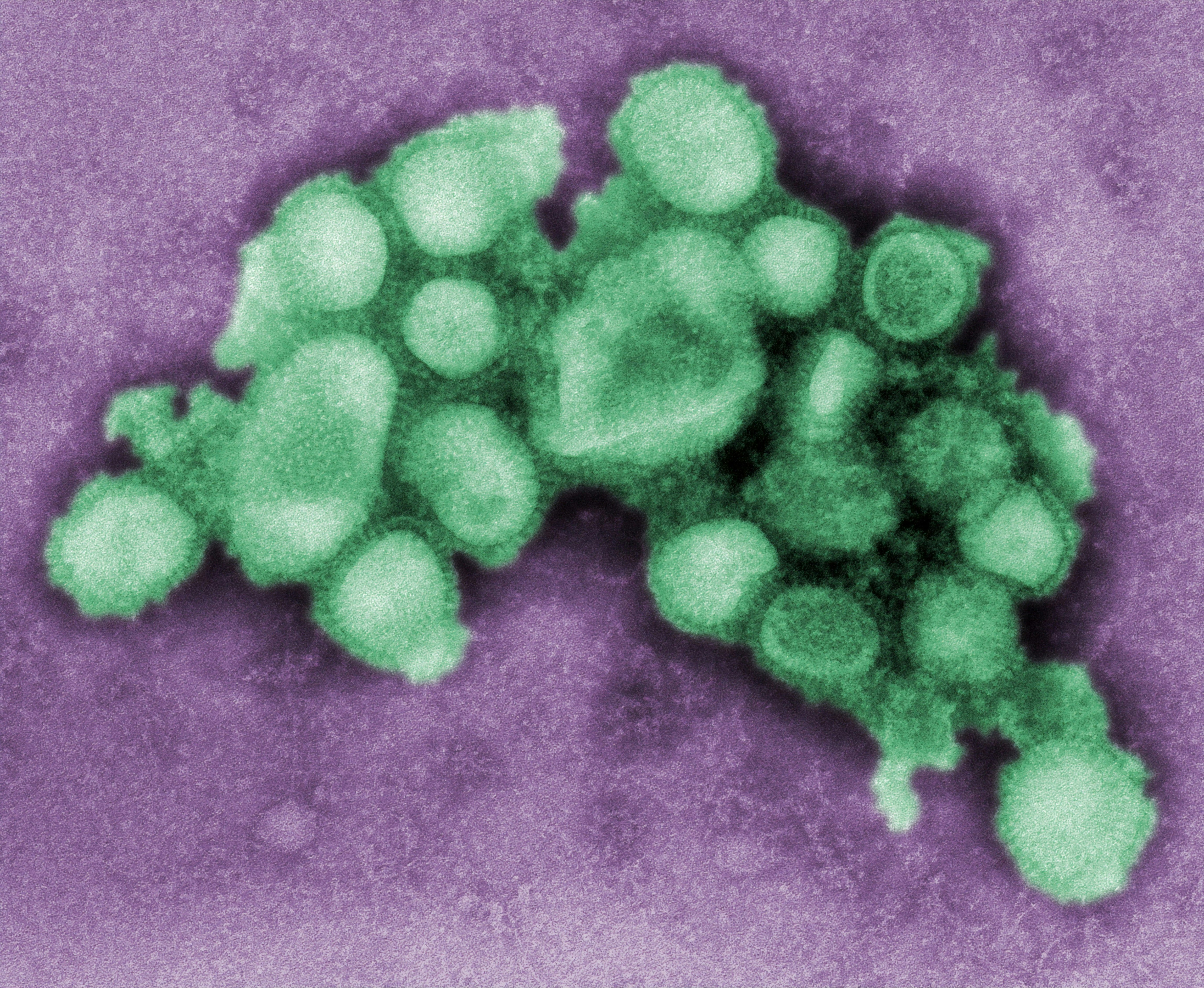 KUOW - Zero flu deaths in Washington state this year, a side effect of coronavirus protections - Vimarsana News