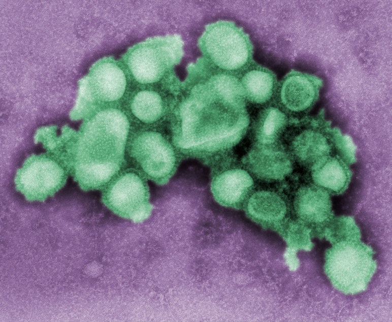 caption: Influenza Virus
