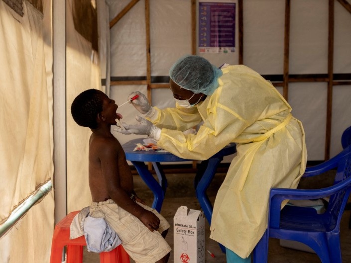 caption: Nurse Christian Musema takes a sample from a child declared a suspected case mpox at the treatment center in Munigi in the Democratic Republic of Congo, where the virus has been surging. Cases have also been identified in four other countries in East Africa.