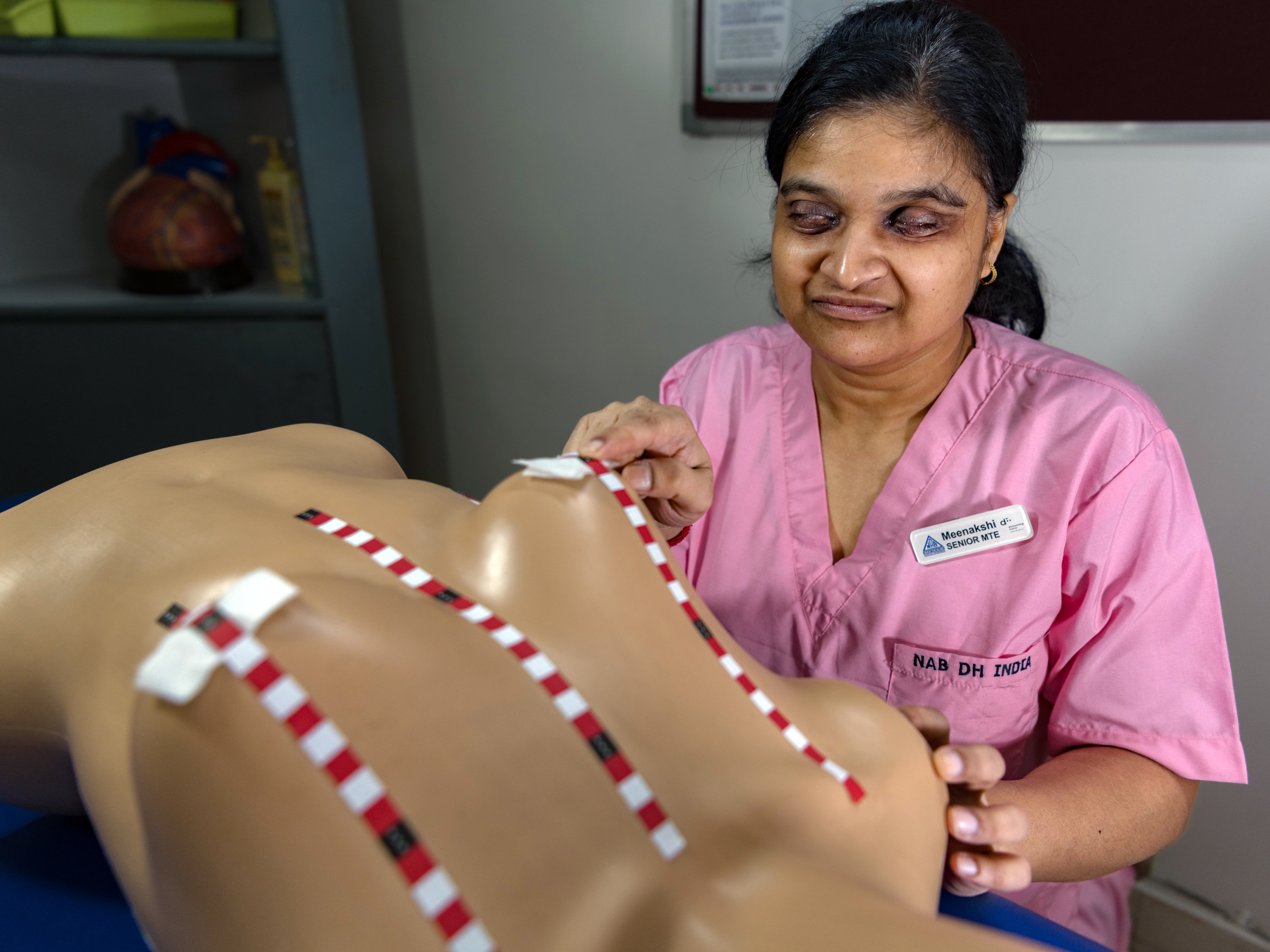 caption: Meenakshi Gupta, who is blind, works as a "medical tactile examiner" to identify breast tumors. The mannequin is used in the training program for would-be examiners. The strips enable the examiners to identify and carefully examine each zone of the breast.