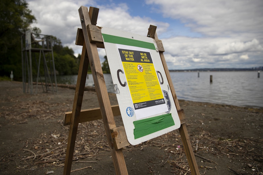 caption: A sign warns swimmers to stay out of the water on Thursday, May 30, 2024, at Mount Baker Beach along Lake Washington in Seattle. 