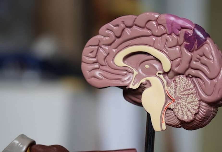 brain generic