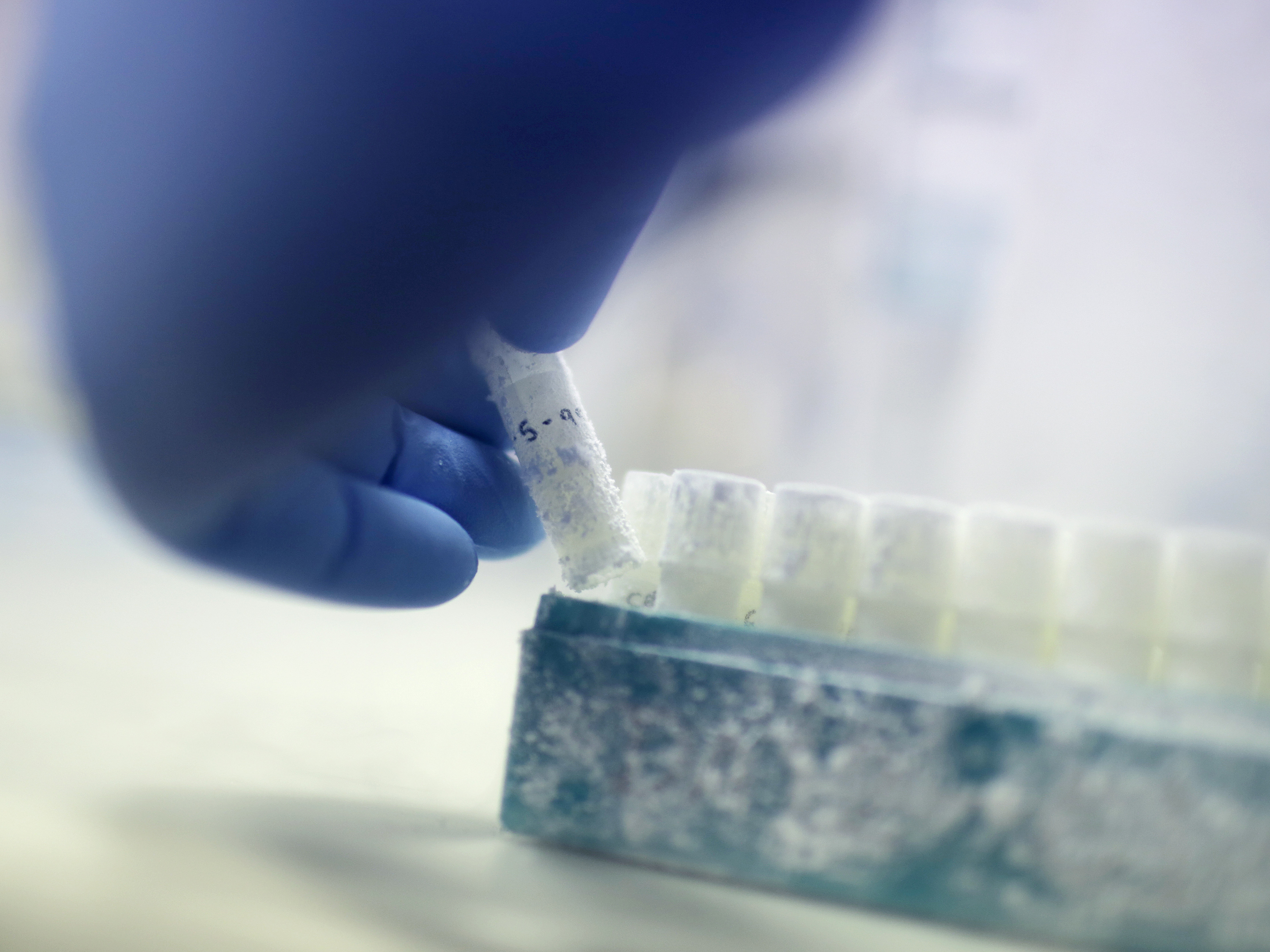 caption: The now-divorced couple is trying to find out what happened to Drew Wasilewski's once-frozen sperm. "They took it and it was defrosted. If they didn't use it for this procedure they must have used it in some other procedure," attorney David Mazie told NPR.