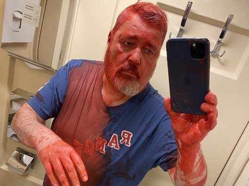 caption: Russian journalist Dmitry Muratov, covered in red paint, takes a picture following the attack on him while on board a train from Moscow to Samara.