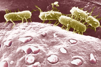 caption: Scanning electron micrograph of <em data-stringify-type="italic">Salmonella typhi</em>, the parasite that causes typhoid fever (in yellow-green, attached to another bacterial cell.