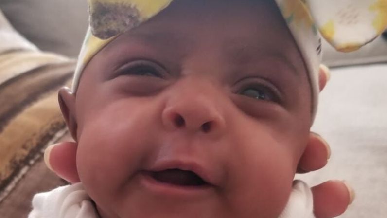 caption: The baby, whom nurses at a San Diego hospital called "Saybie," is believed to be the world's tiniest surviving newborn.
