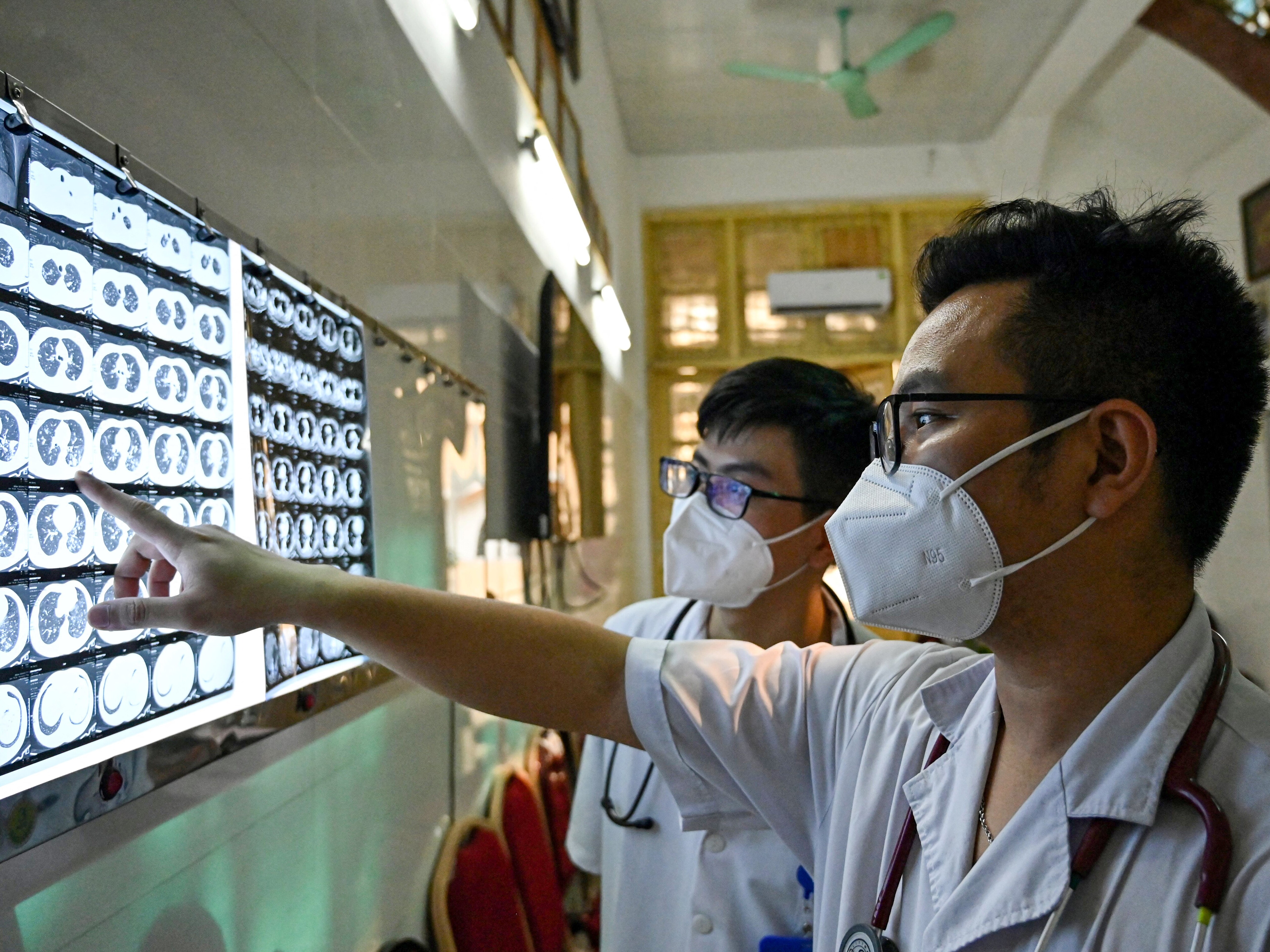 caption: Vietnamese doctor Truong Duc Thai and a colleague check the X-ray film of a drug-resistant tuberculosis patient at National Lung Hospital in Hanoi. TB kills more people than any other infectious disease. A new study projects that U.S. aid cuts will worsen its toll.