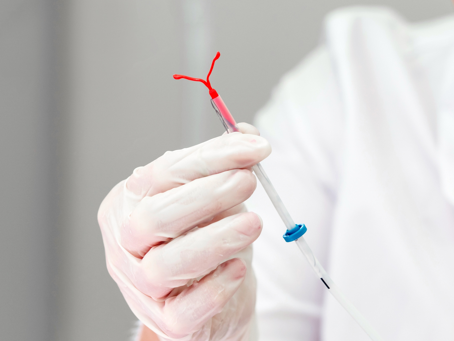 caption: Some patients experience pain or discomfort with the insertion of an IUD for contraception. New guidelines urge doctors to offer pain treatment.