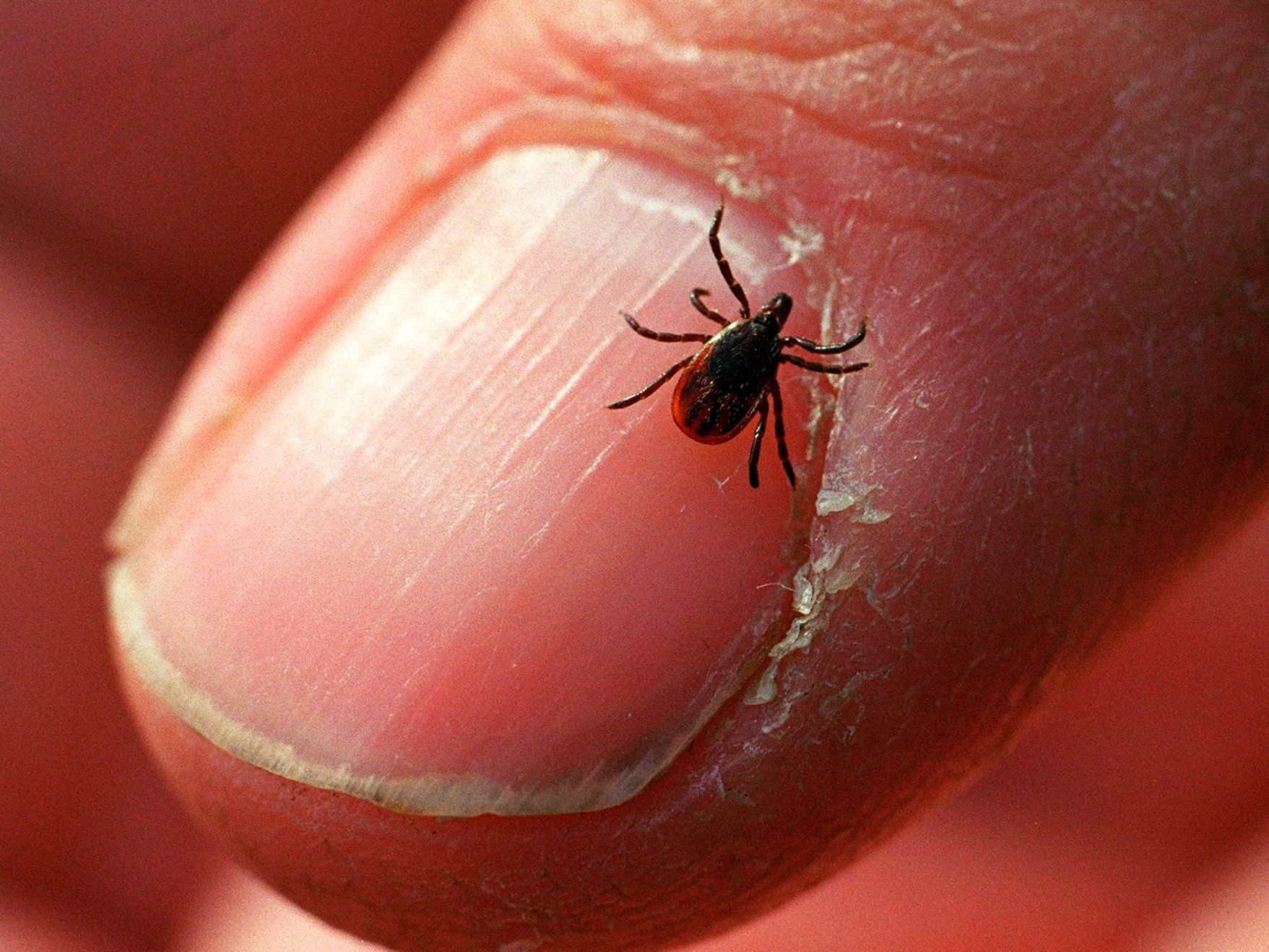 caption: The black-legged or deer tick, which carries Lyme disease, appears to be expanding it's territory.