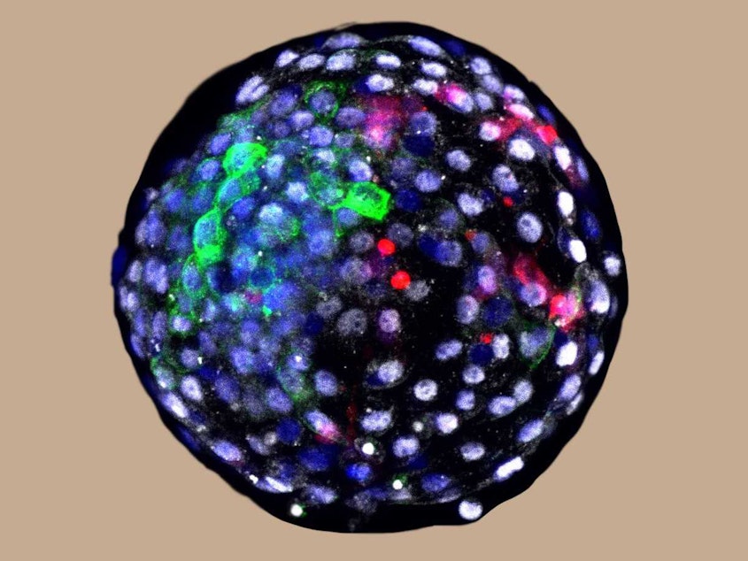caption: Using fluorescent antibody-based stains and advanced microscopy, researchers are able to visualize cells of different species origins in an early stage chimeric embryo. The red color indicates the cells of human origin.