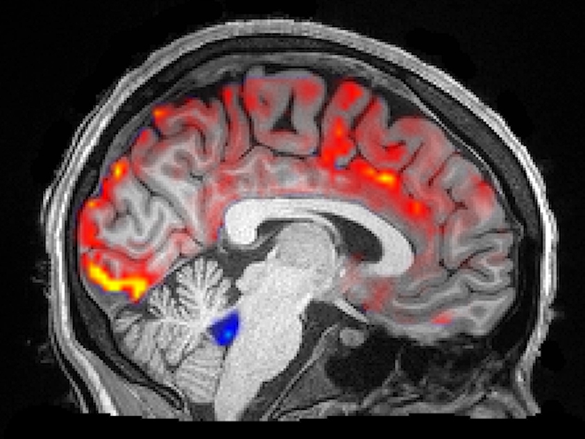 caption: During deep sleep, waves of cerebrospinal fluid (blue) coincide with temporary decreases in blood flow (red). Less blood in the brain means more room for the fluid to carry away toxins, including those associated with Alzheimer's disease.